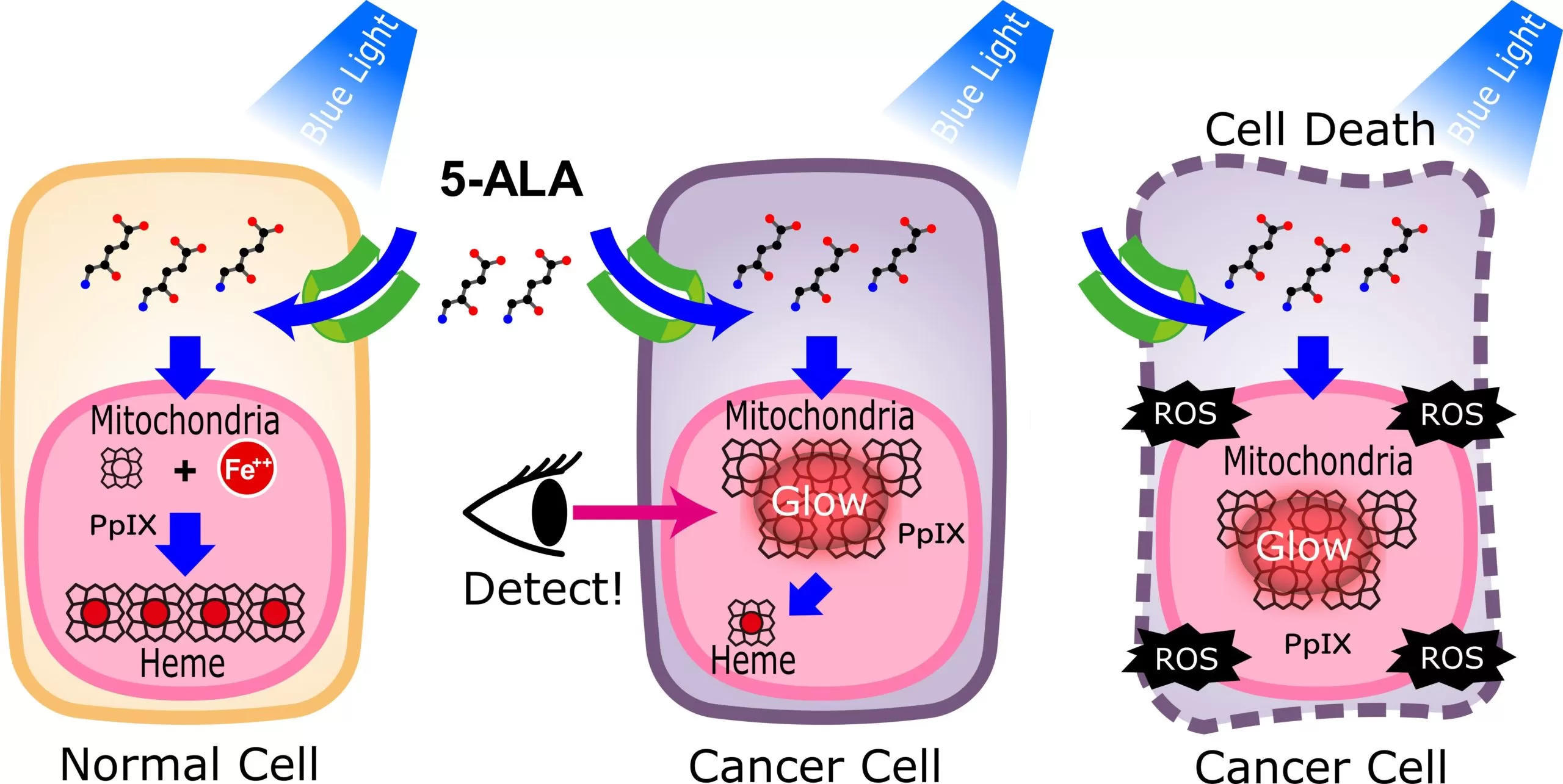 The Role of 5-Aminolevulinic Acid in Brain Tumor Surgery: A Systematic Review